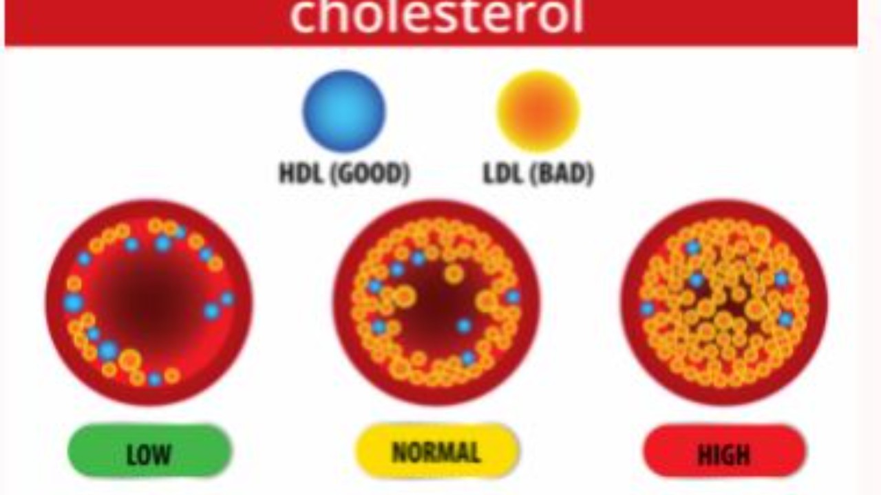 cholestrol